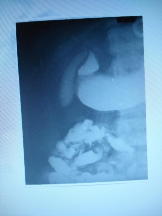Examinare radiologică simultană a tubului digestiv